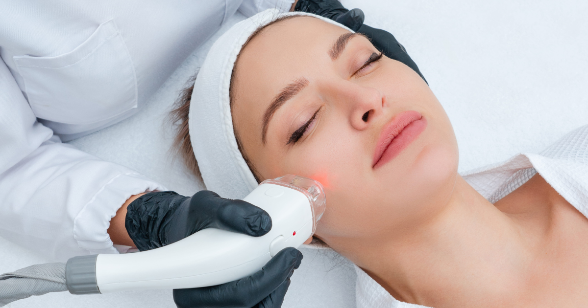 Neo Skin Laser Treatment session on woman's face at a clinic in Sidney, NE